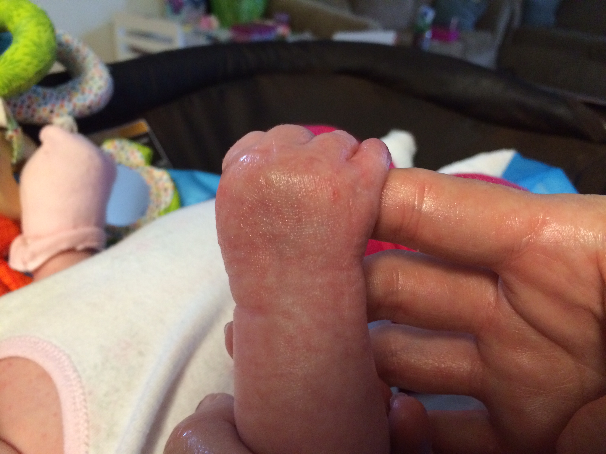 Kiira's right hand at 6 weeks